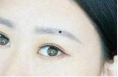 <b>眉中藏有痣代表什么 命运如何</b>